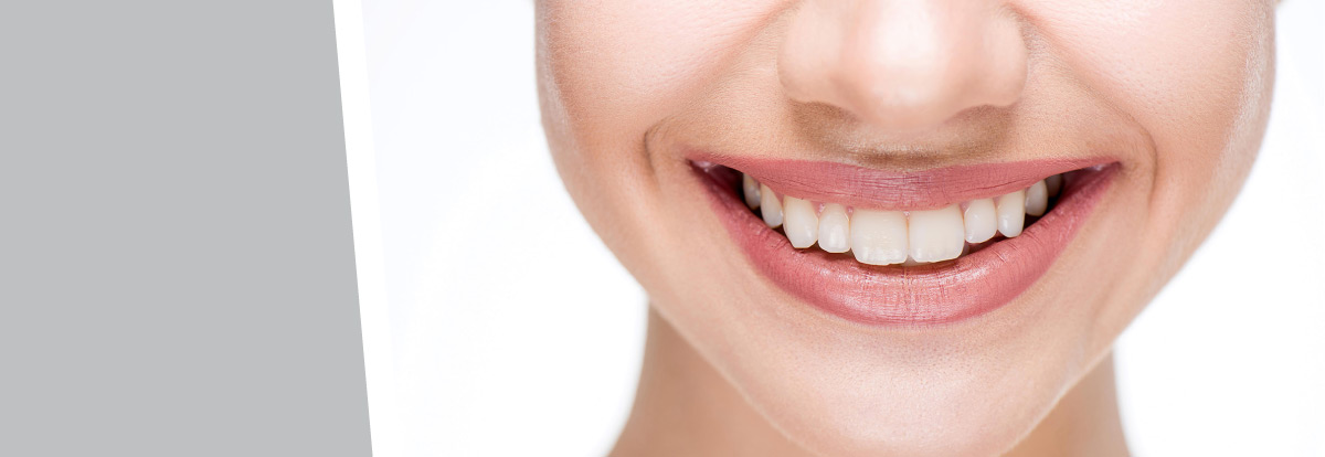 Retainer